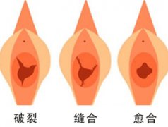 和田处女膜修补手术哪家医院好